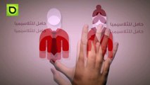 مرض الثلاسيميا ماهو ؟ و ماهي اسبابه ؟ وما هي اعراض الثلاسيميا ؟ | Sehatona.com | HD