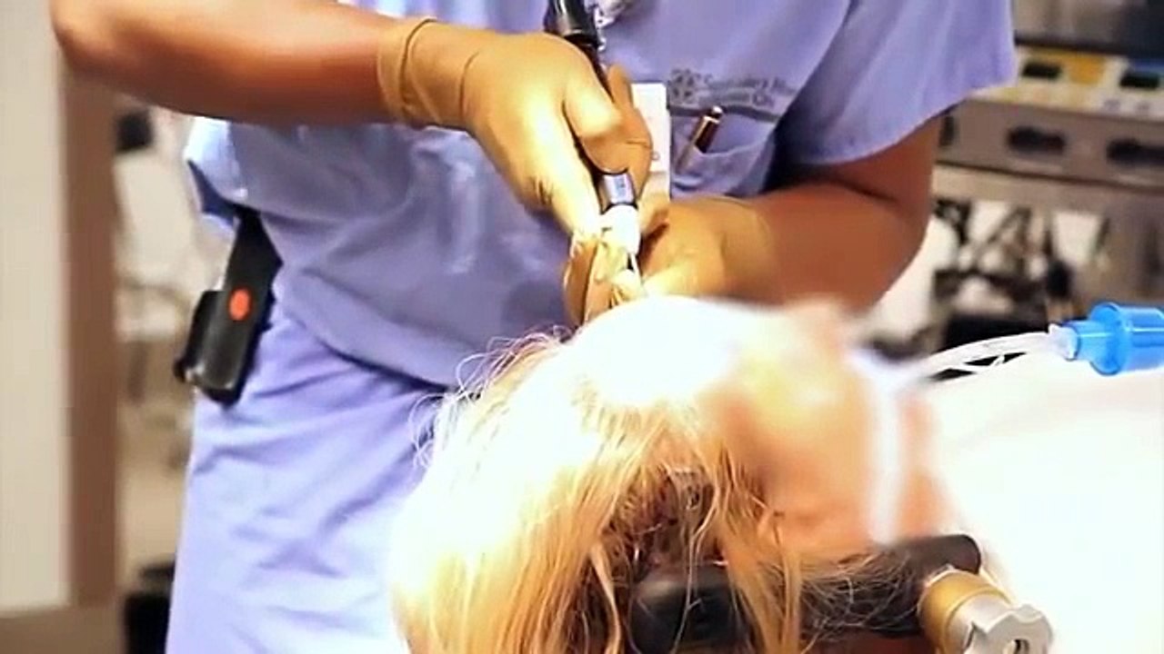 CereTom® Assisted Deep Brain Stimulation (DBS) Surgery with Dr. Stephen E. Griffith