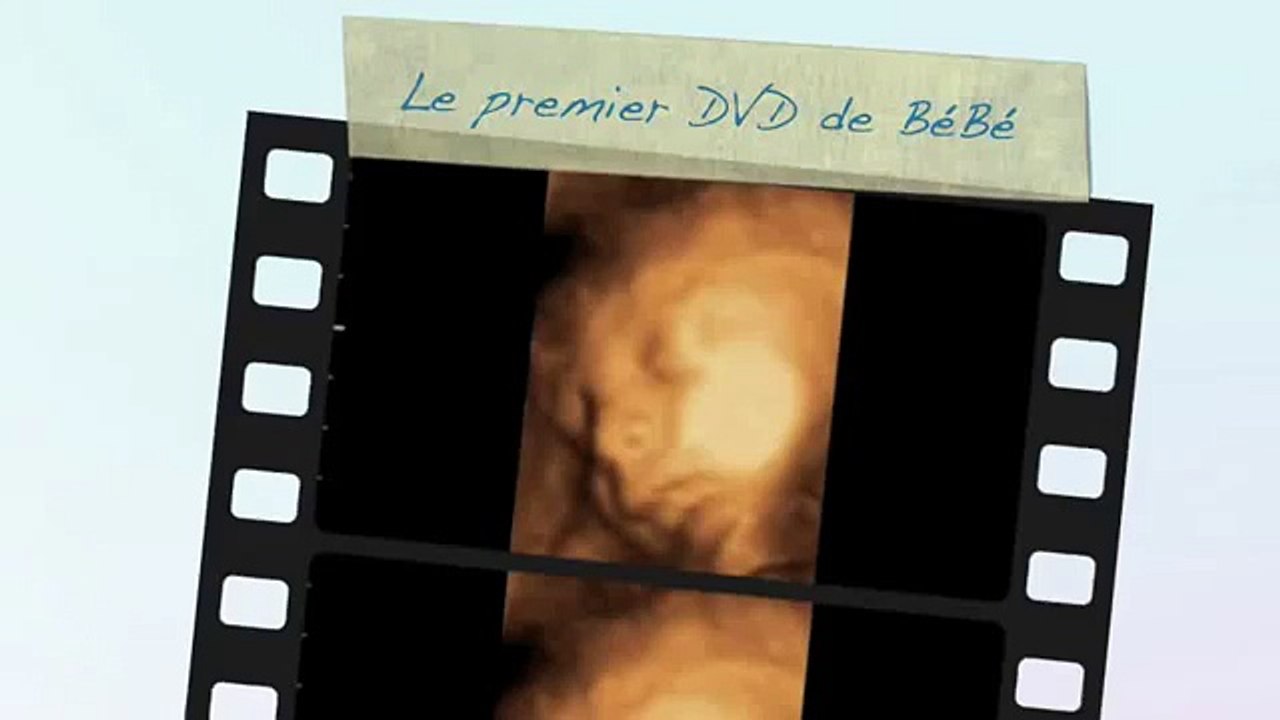 Echographie Souvenir 3D 4D chez Baby Live Montpellier