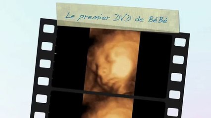 Echographie Souvenir 3D 4D chez Baby Live Montpellier