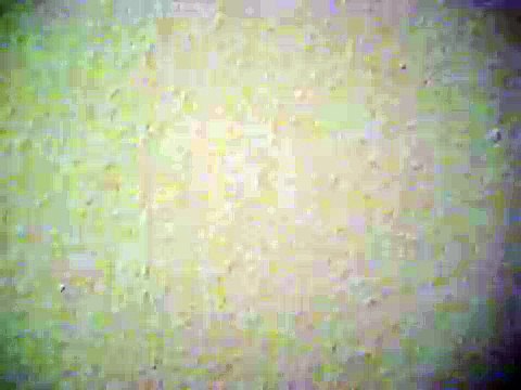 Skitzo Dancer, disco disco