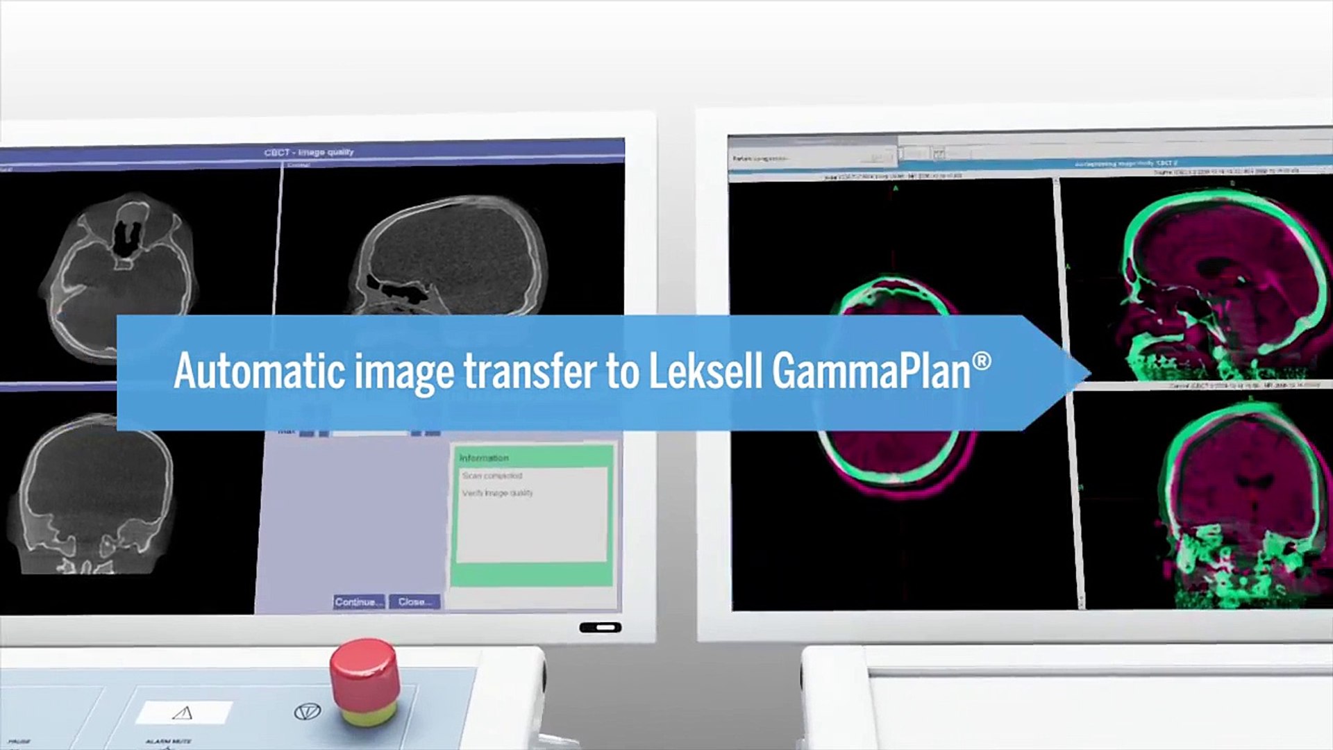 ⁣Leksell Gamma Knife® Icon™