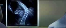 Meet Brandi: Spinal fusion surgery - Television Commercial