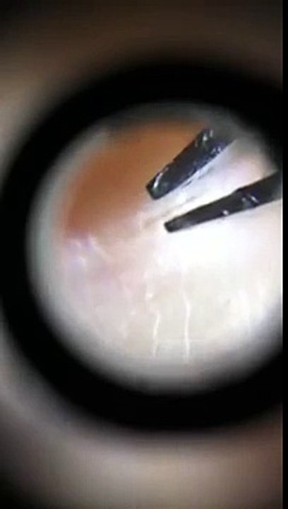 Pulling Hairs at 60x Magnification