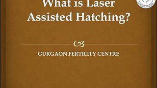 What is laser assisted hatching