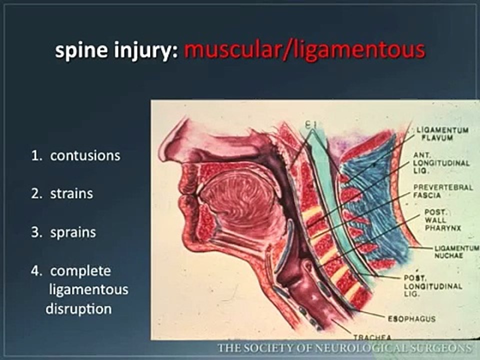 Emergency Spinal Radiological Assessment