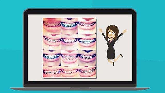 Braces in Salt Lake City