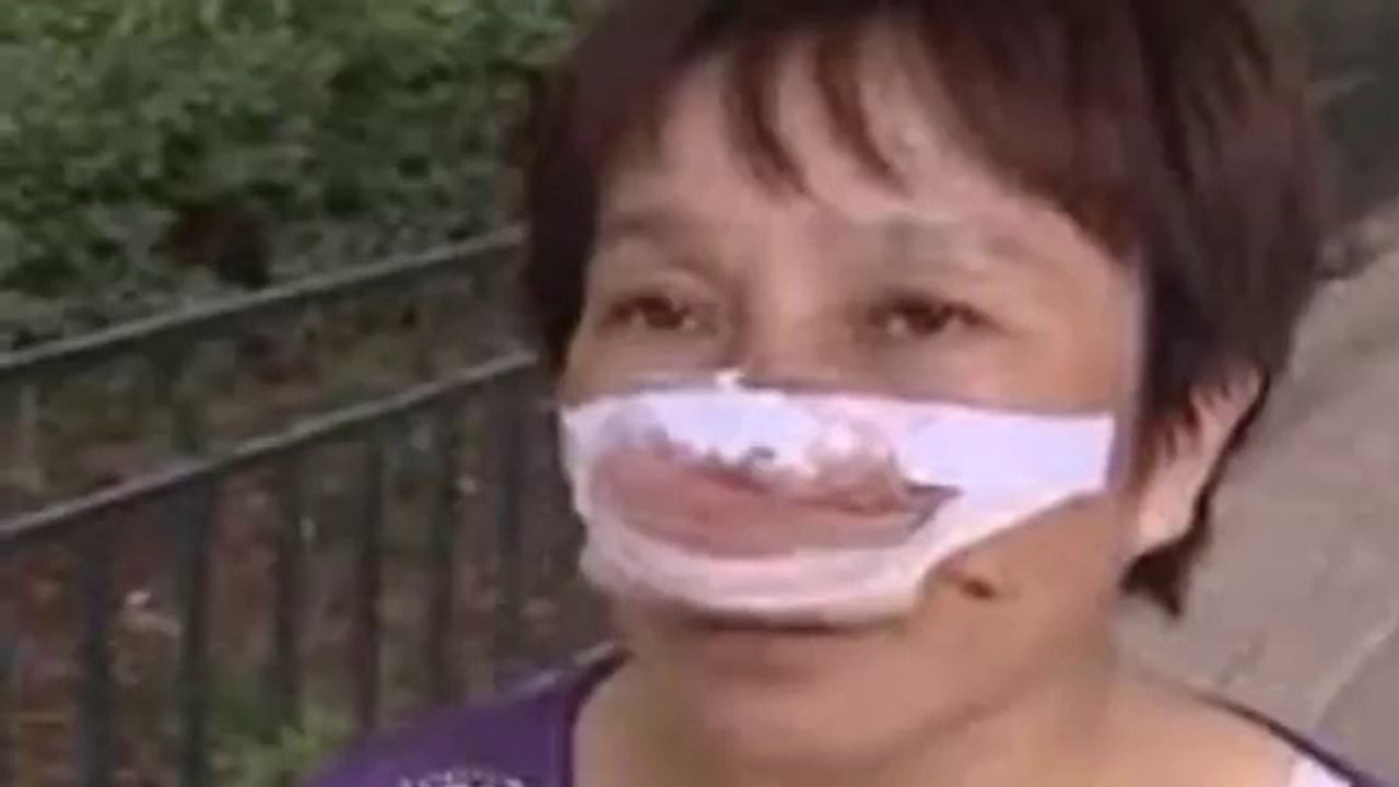 Shandong man bites off and eats wife's nose after she fails to answer his calls