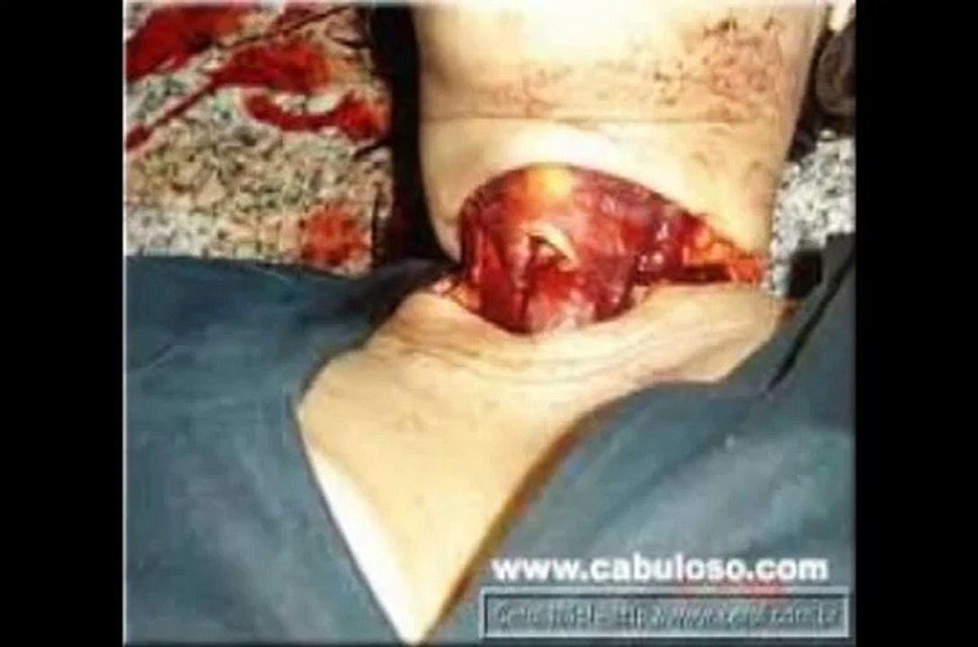 QUANTO CUSTA UM ACIDENTE DE TRABALHO.wmv