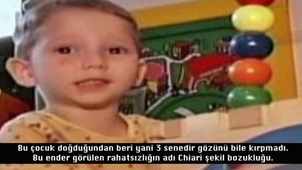 Dünyanın En İlginç Doğan 10 Bebeği (Çok Şaşıracaksınız)