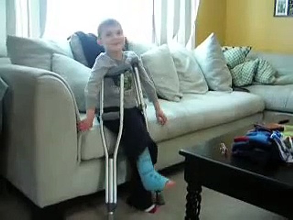 Conner Broken Leg