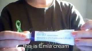 Emla Cream Application for Hemo Dialysis