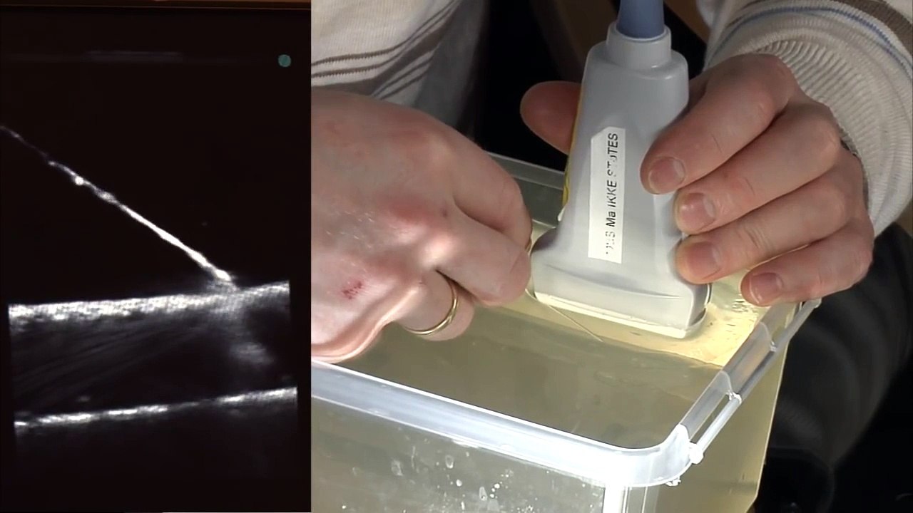 The use of Gelatine models in Ultrasound guided Intravenous Cannulation