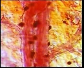 Stop it! : Documentary on Tobacco Addiction and Deaddiction