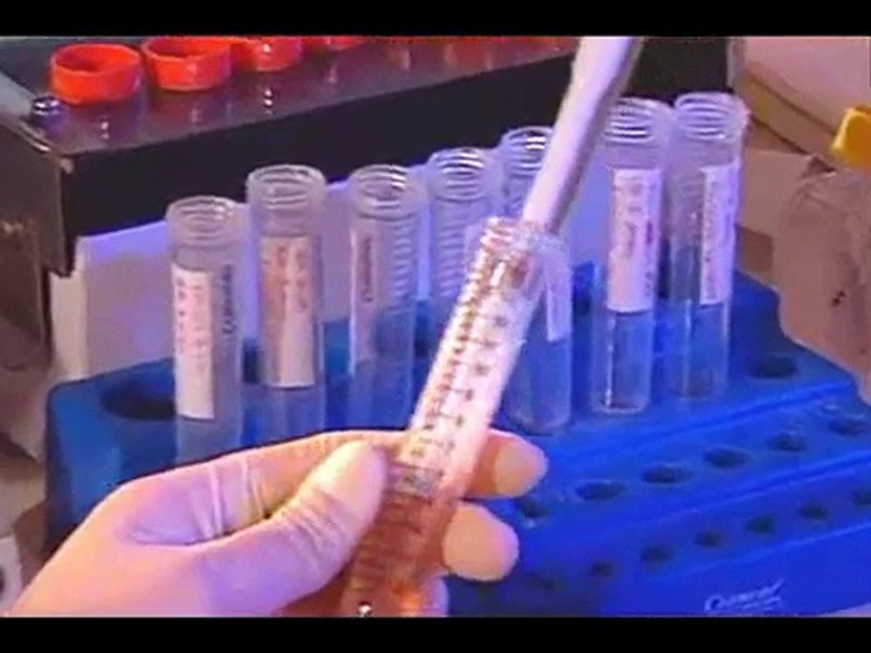 Lesão Medular.