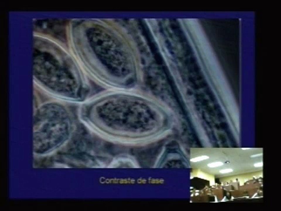 ASCARIS LUMBRICOIDES (Abril-Agosto 2008)