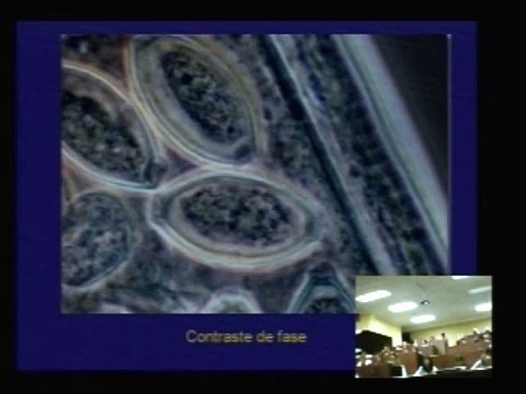 ASCARIS LUMBRICOIDES (Abril-Agosto 2008)