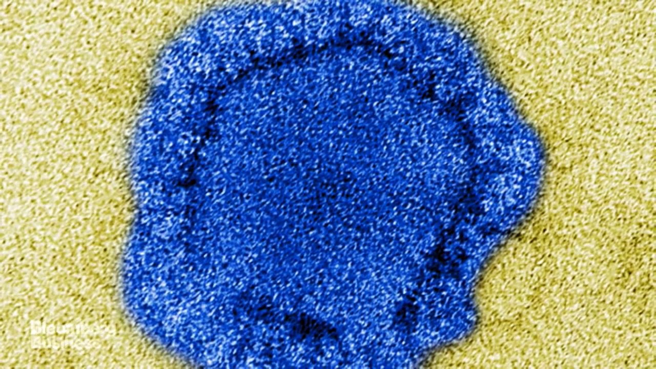 MERS Virus Outbreak: Everything You Need to Know