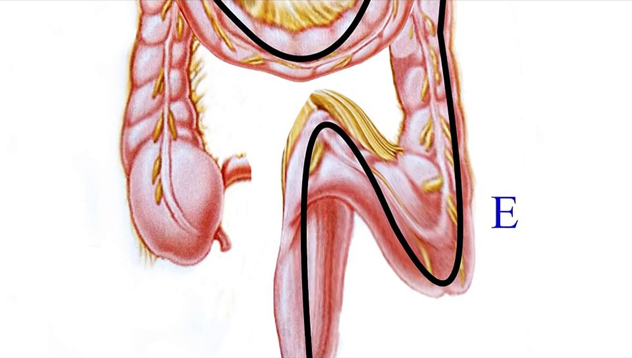 Il Cancro al colon Oggi - a cura del dott.Paternuosto