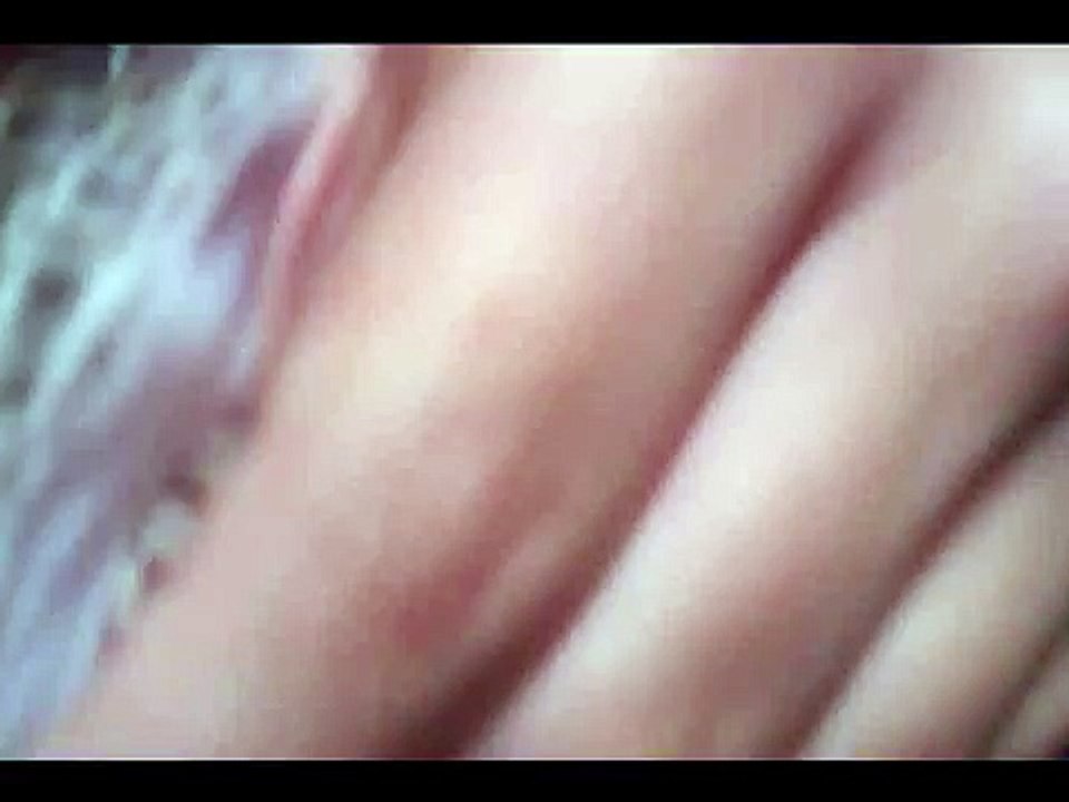 Dreng bliver bidt af en Øgle