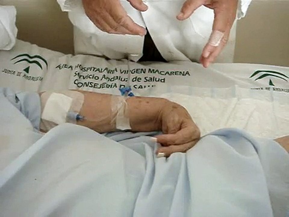 CLONUS DE MANO,ROTULA Y PIE POR ANTIGUA HEMIPLEJIA IZQUIERDA