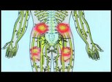 BACK PAIN LEG PAIN HERNIATED DISC SCIATICA PINCHED NERVE RELIEF DOCTOR NJ NEW JERSEY BERGEN COUN... (Low)(1)