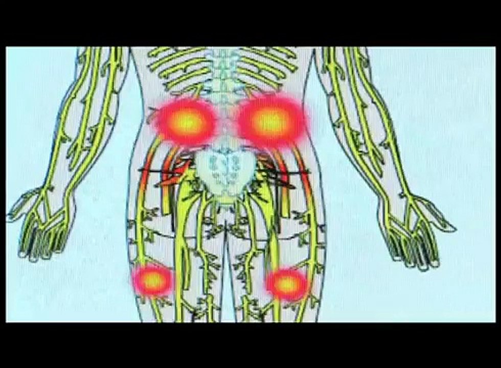 BACK PAIN LEG PAIN HERNIATED DISC SCIATICA PINCHED NERVE RELIEF DOCTOR NJ NEW JERSEY BERGEN COUN... (Low)(4)