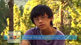 Children's Colorado Burn Camp