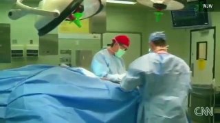 Surgeons attach boy's leg backward
