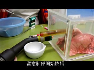 Les effrayants  effets du tabac sur  les poumons Fyntie25