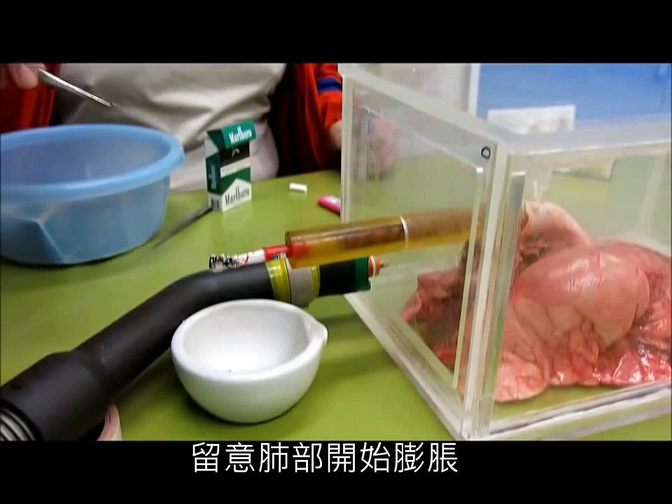 Les effrayants  effets du tabac sur  les poumons Fyntie25