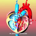 Congenital heart defects I: ASD, VSD, AS, PS, PDA and PFO