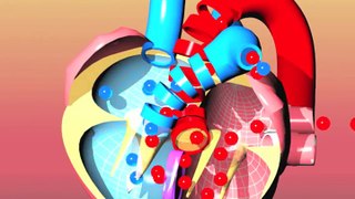 Congenital heart defects I: ASD, VSD, AS, PS, PDA and PFO