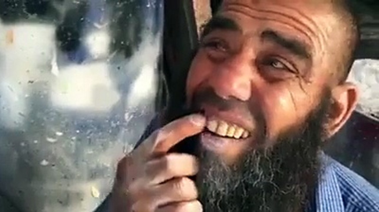 Arab Teeth Whitening | تبييض أسنان عند ميكانيكي