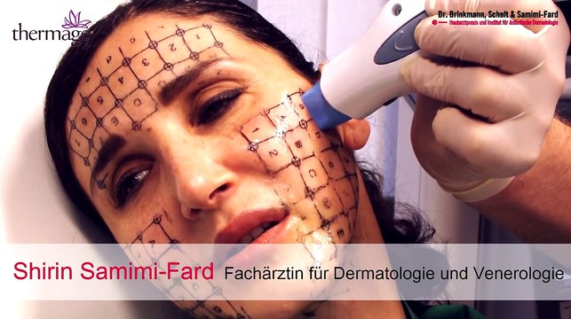 THERMAGE-LIVEBEHANDLUNG | Hautstraffung ohne OP | Aknenarben | DERMA LOFT Gladbeck
