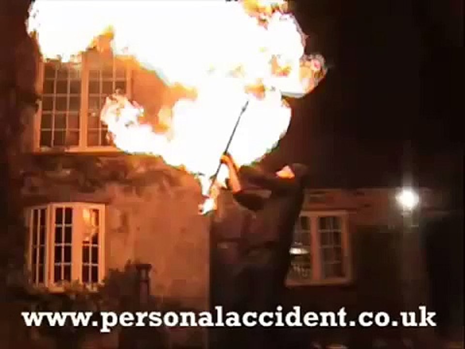 Kid fire dancing   poi boy accident