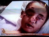 Gaza's Children - Al Jazeera clip - Sun, Jan 25, 2009