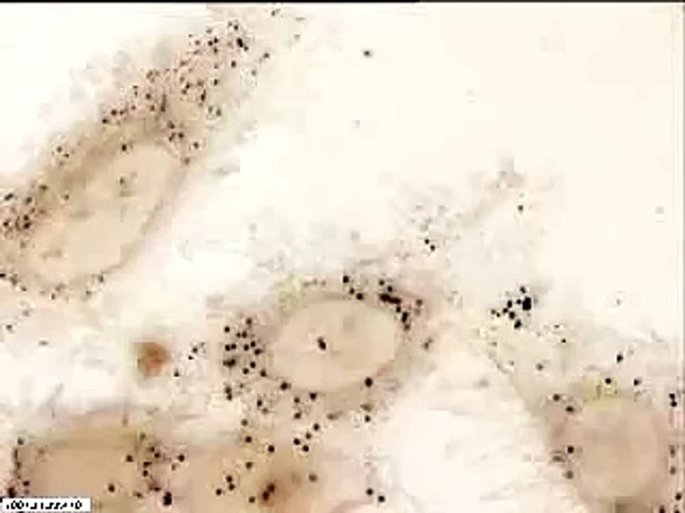 HeLa cells dividing over 27hrs cells round up g...