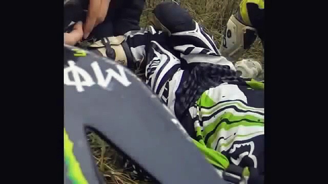Crazy Dirt Bike CRASH - Broken Leg!