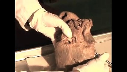 Right Side of Calf Heart