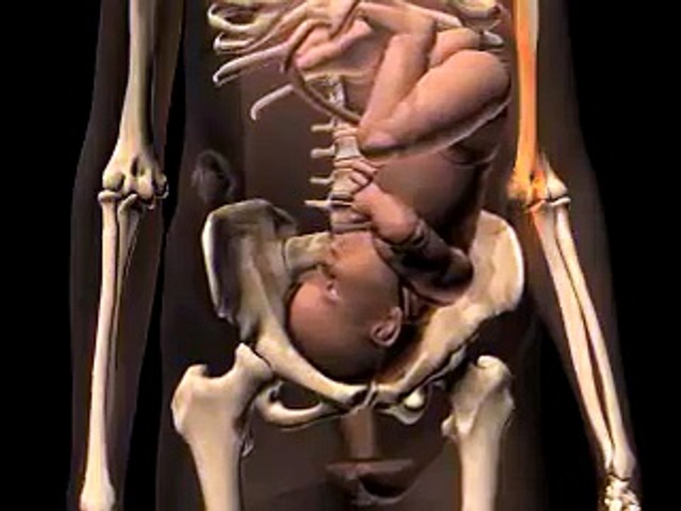 L'accouchement en 3D