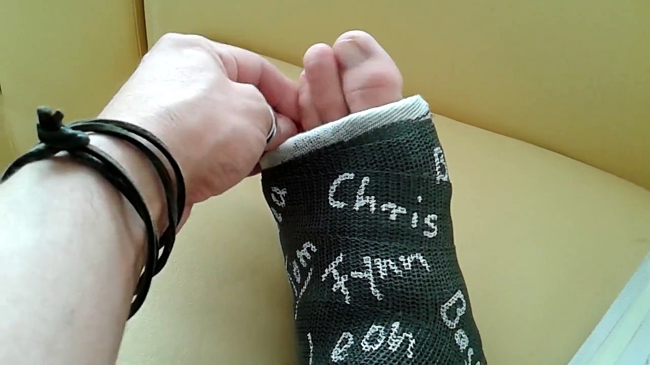 SLC Cast Gips Black - Adidas Superstar - 2cm Beinlängendifferenz - 23.08.2015 - 4