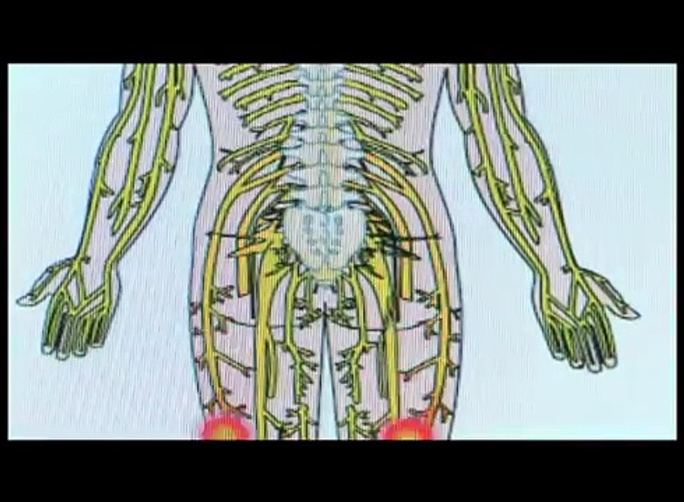 FIBROMYALGIA & CHRONIC FATIGUE DRUG FREE TREATMENT PAIN RELIEF NORTHERN NJ NEW JERSEY BERGEN County