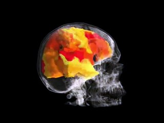 Woman's BRAIN while having an ORGASM   fMRI Scan