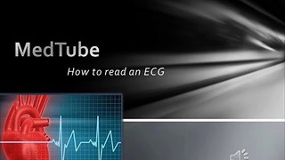 How to read an ECG easily