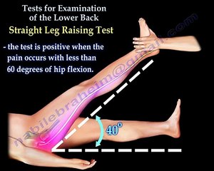 Tests For Examination Of The Lower Back