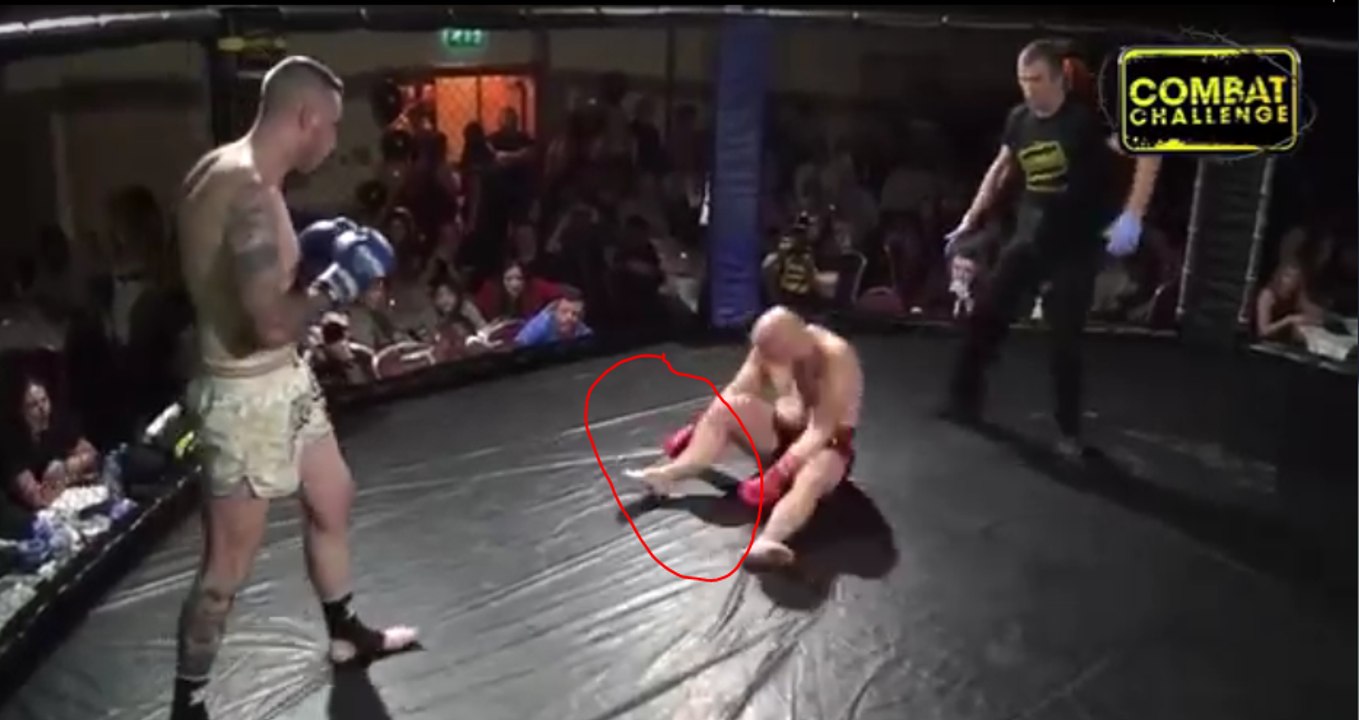 MMA Match Ends When The Fighter Steps Backwards