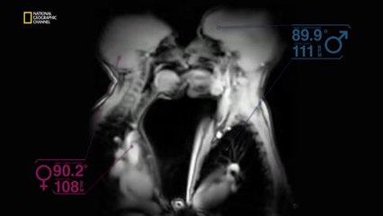 Kal Penn ile Büyük Resim: Cinsel Dürtüler