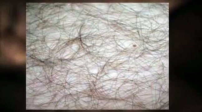 Pain Less Brazilian Waxing Sydney