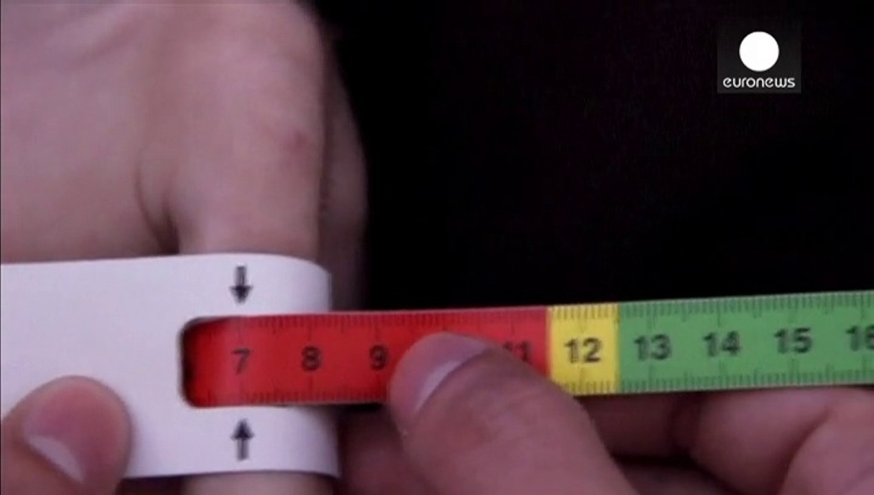 Immer mehr unterernährte Kinder in Syrien